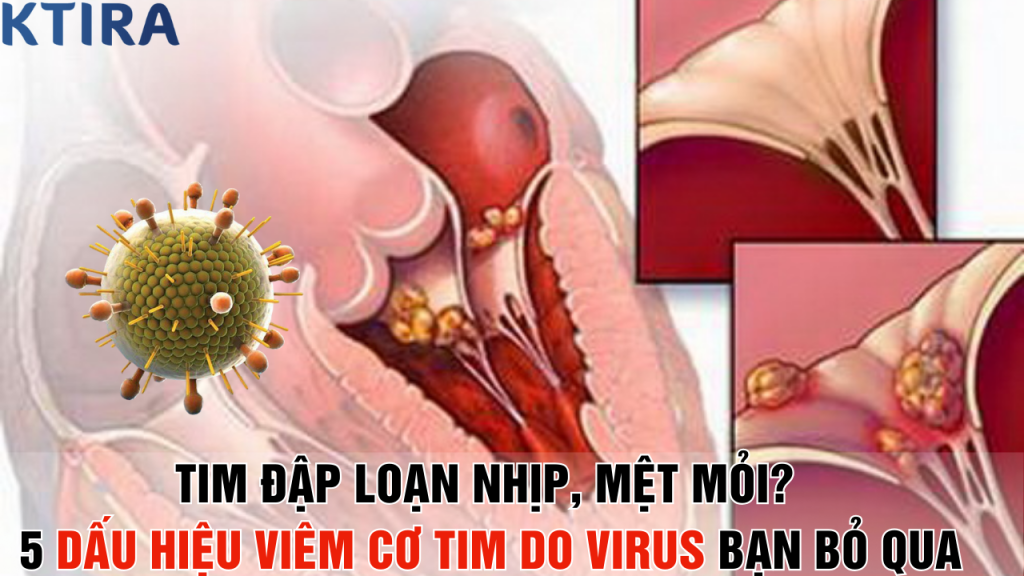Tim Đập Loạn Nhịp, Mệt Mỏi? 5 Dấu Hiệu Viêm Cơ Tim Do Virus Bạn Bỏ Qua