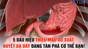 5 Dấu Hiệu Thiếu Máu Do Xuất Huyết Dạ Dày Có Thể Đang Tàn Phá Cơ Thể Bạn!