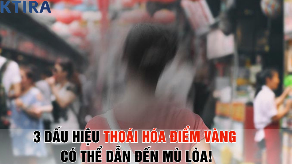 3 Dấu Hiệu Thoái Hóa Điểm Vàng Có Thể Dẫn Đến Mù Lòa!