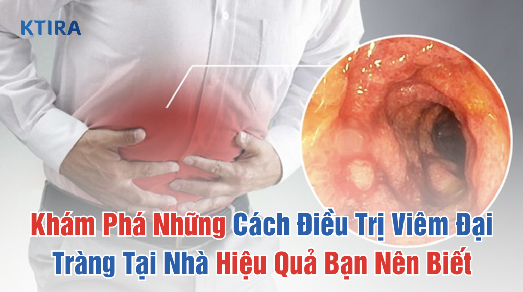 Cách Điều Trị Viêm Đại Tràng Tại Nhà KTIRA