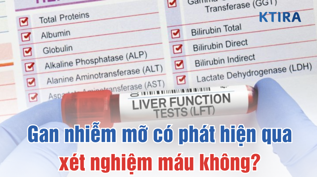 Gan nhiễm mỡ có phát hiện qua xét nghiệm máu không? KTIRA