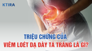 Triệu chứng của viêm loét dạ dày tá tràng là gì KTIRA