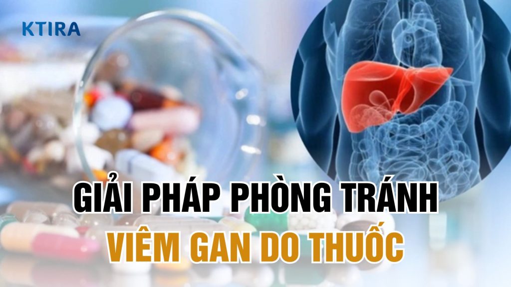 Giải pháp phòng tránh viêm gan do rượu