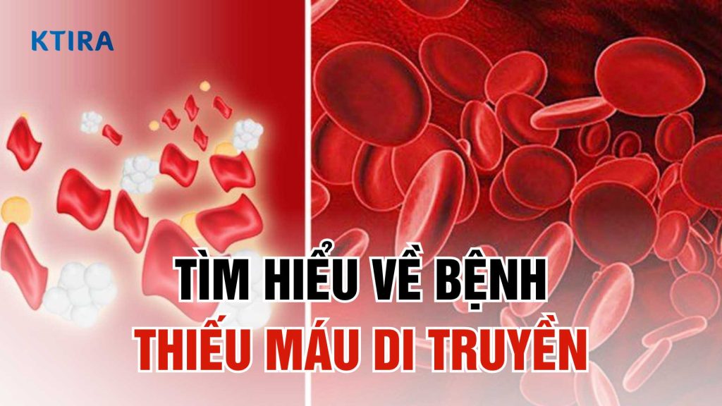 Thiếu máu di truyền