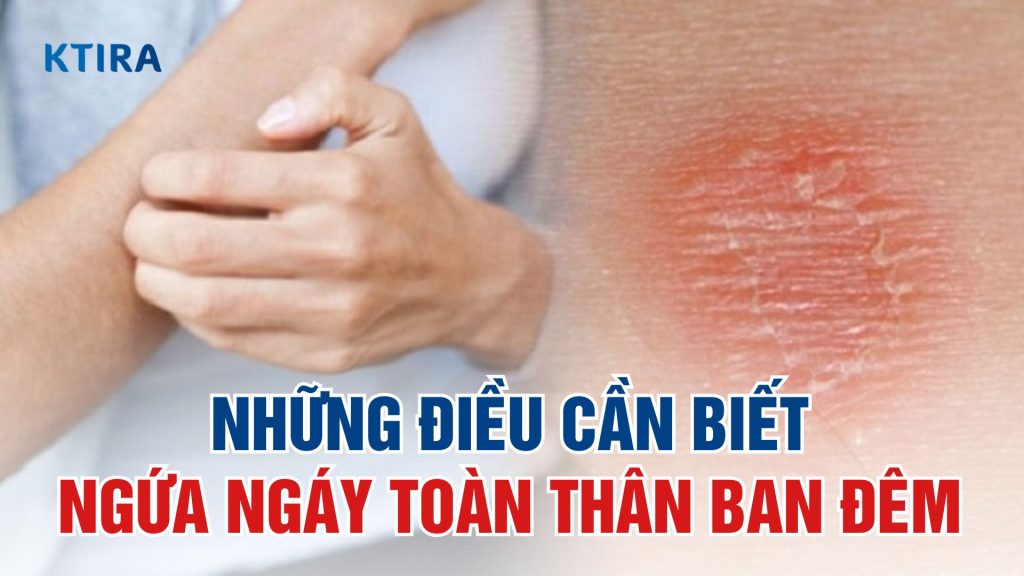 Ngứa ngáy toàn thân ban đêm