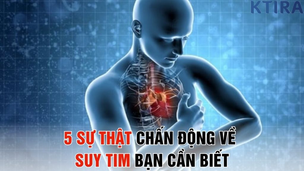 5 Sự Thật Chấn Động Về Suy Tim Bạn Cần Biết
