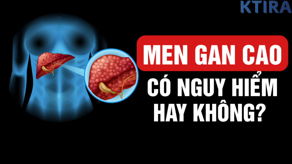 Men Gan Cao Có Nguy Hiểm Không? 5 Dấu Hiệu Cảnh Báo Và Cách Bảo Vệ Gan!