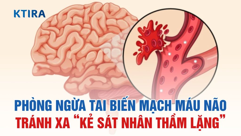 Bí Quyết Phòng Ngừa Tai Biến Mạch Máu Não KTIRA