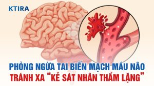 Bí Quyết Phòng Ngừa Tai Biến Mạch Máu Não KTIRA