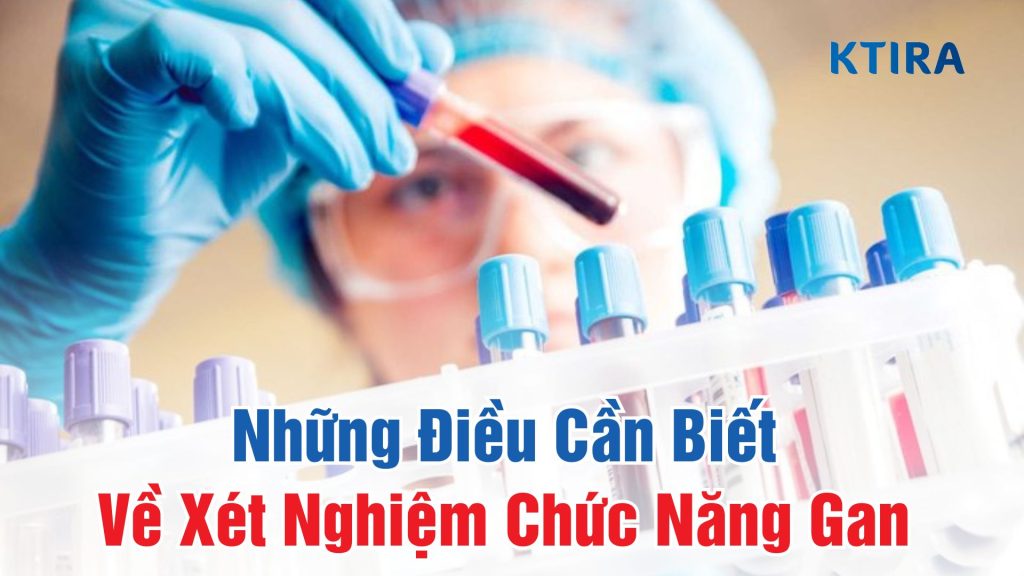 Điều cần biết về xét nghiệm chức năng gan KTIRA