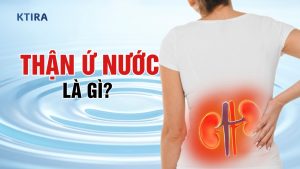 Thận Ứ Nước Là Gì
