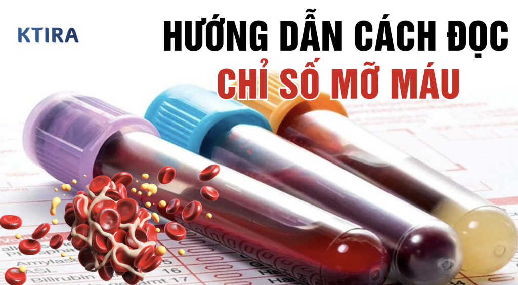 Cách đọc chỉ số mỡ máu Dr Ngọc