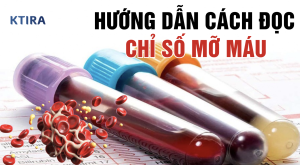 Cách đọc chỉ số mỡ máu Dr Ngọc