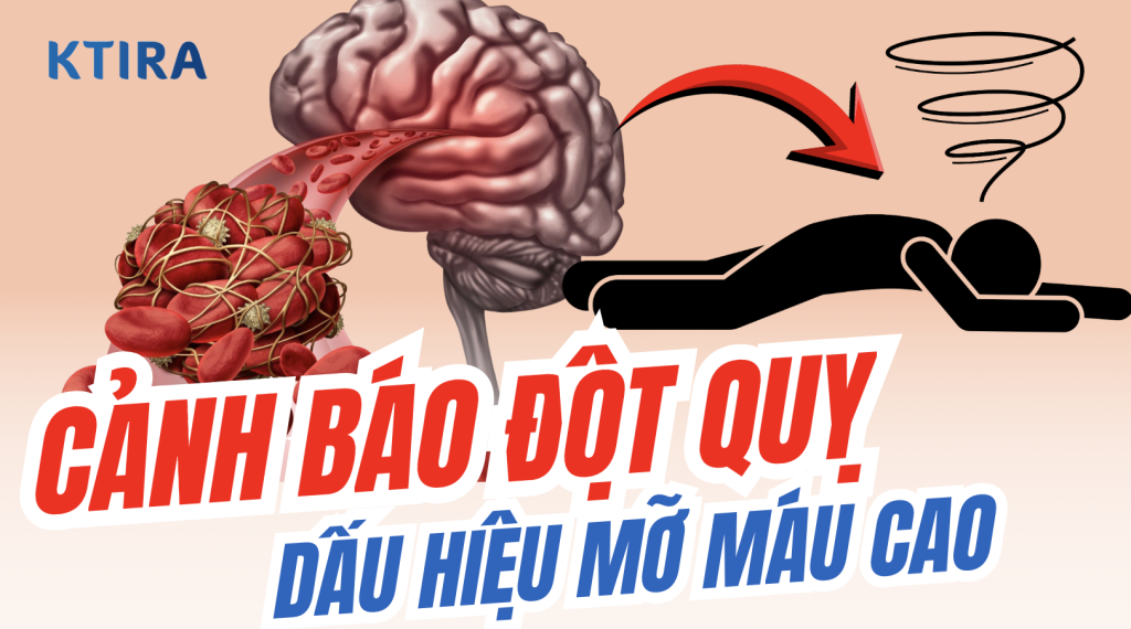 Dấu hiệu mỡ máu cao cảnh báo đột quỵ KTIRA